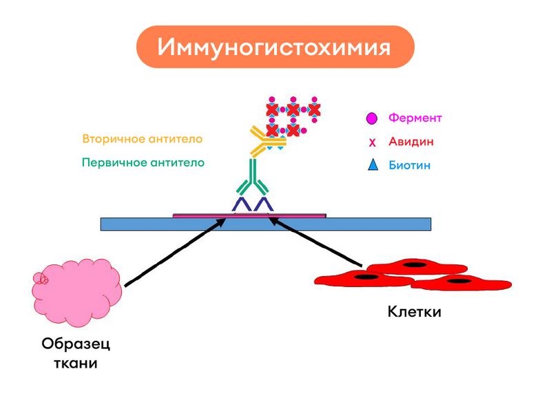 Что такое иммуногистохимическое исследование