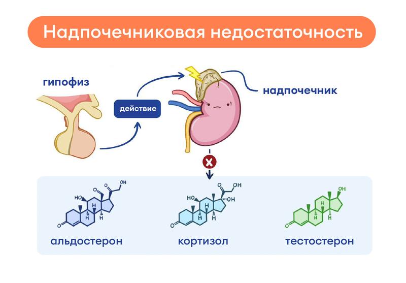 Причины надпочечниковой недостаточности