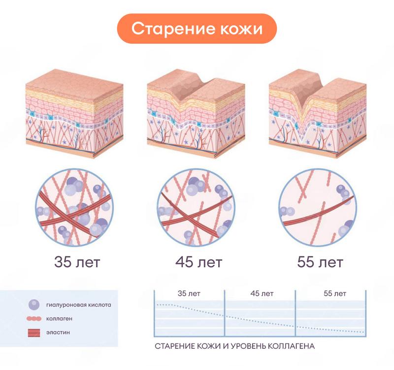 Превентивный подход