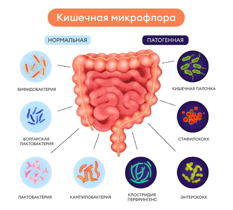 Дисбактериоз: симптомы, причины, диагностика, лечение и профилактика